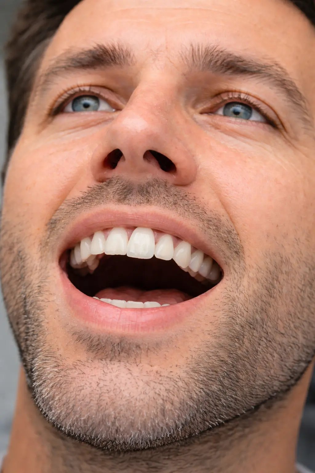 Restored anterior implant