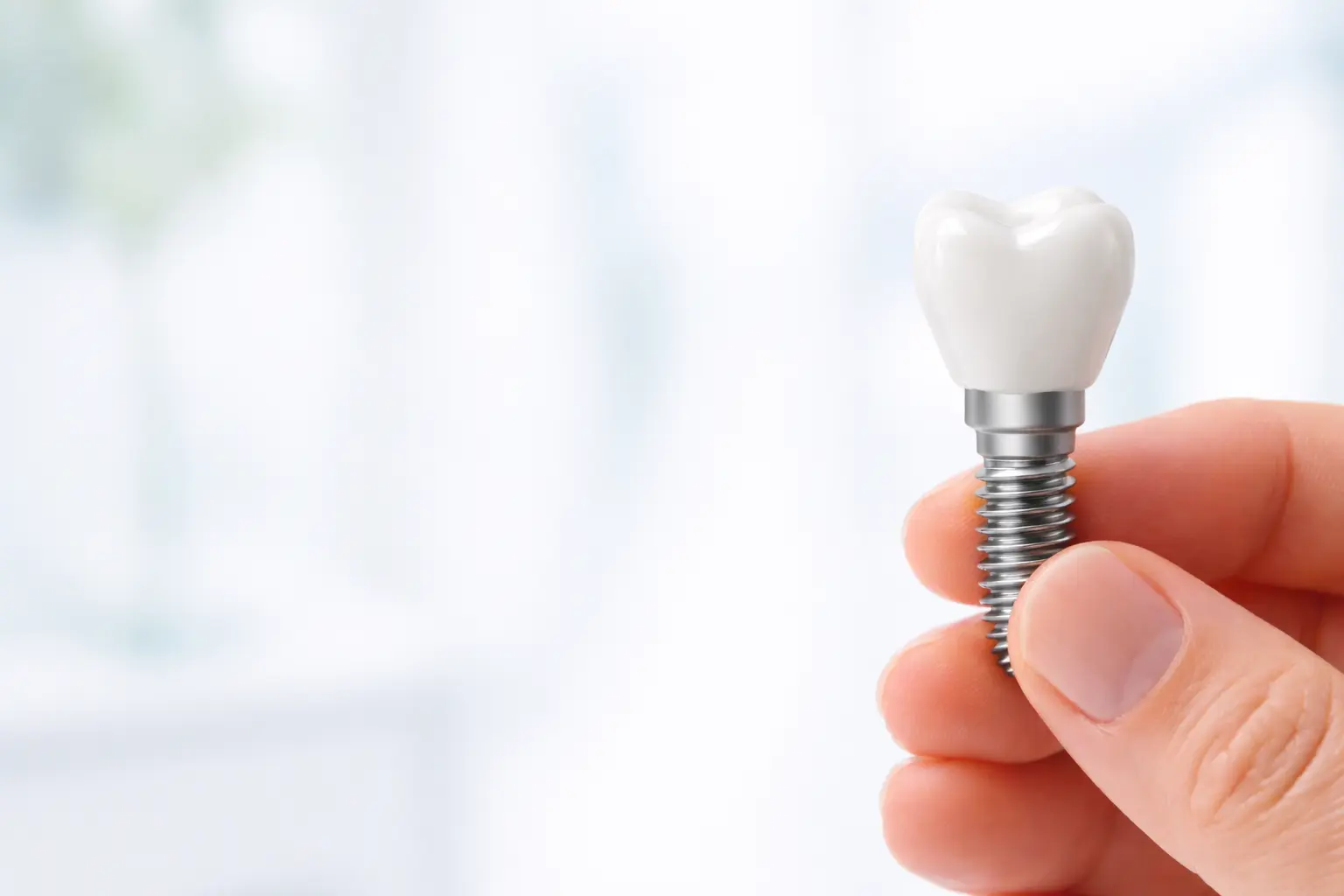 Permanent Dental Implants Surgery